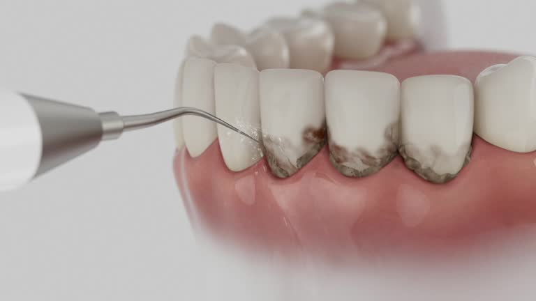 Trusted Dental Crowns And Bridges service in Newton, MS - Dentist Open Now